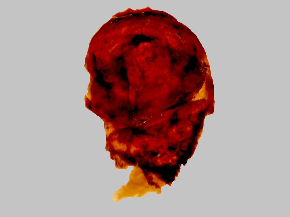 Bild Nr.08727 zum Vergrößern klicken Bild Nr.08727